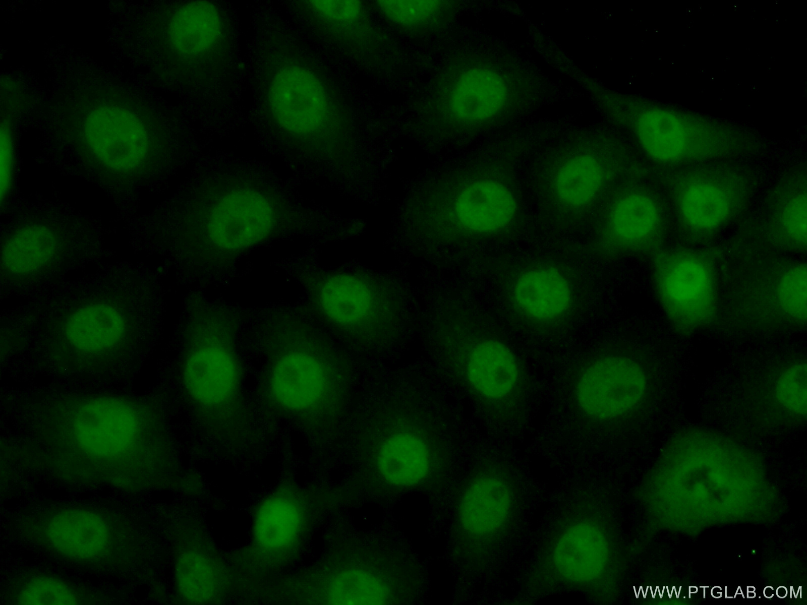 IF Staining of SH-SY5Y using 16218-1-AP