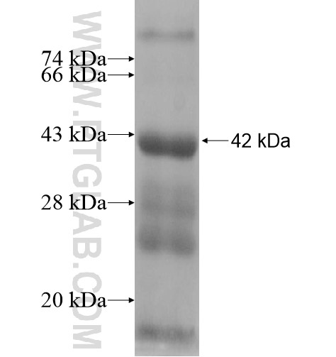 ZNF45 fusion protein Ag11124 SDS-PAGE ZNF45 fusion protein Ag11124 SDS-PAGE