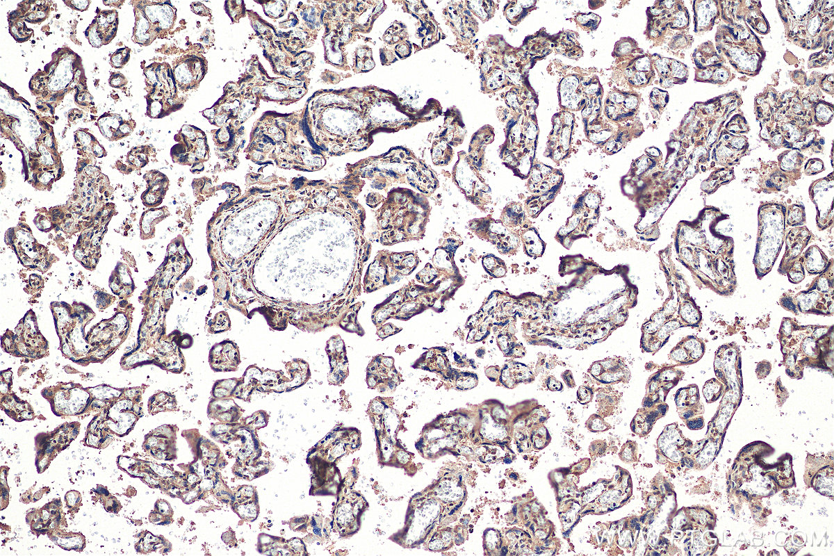 IHC staining of human placenta using 25228-1-AP