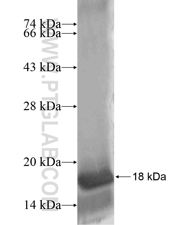 ZNF460 fusion protein Ag18144 SDS-PAGE ZNF460 fusion protein Ag18144 SDS-PAGE