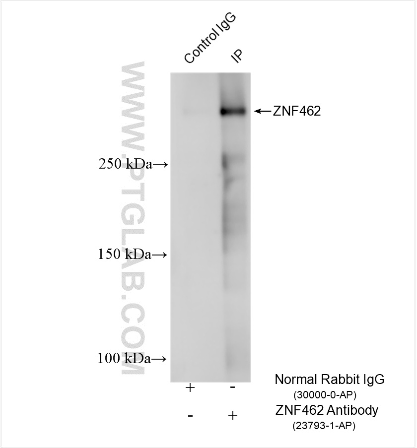 IP experiment of mouse eye using 23793-1-AP