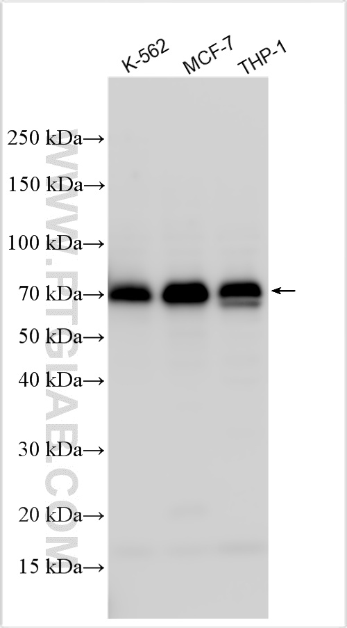 WB analysis using 31411-1-AP (same clone as 31411-1-PBS)