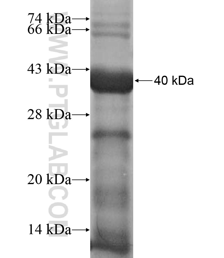 ZNF484 fusion protein Ag17349 SDS-PAGE ZNF484 fusion protein Ag17349 SDS-PAGE