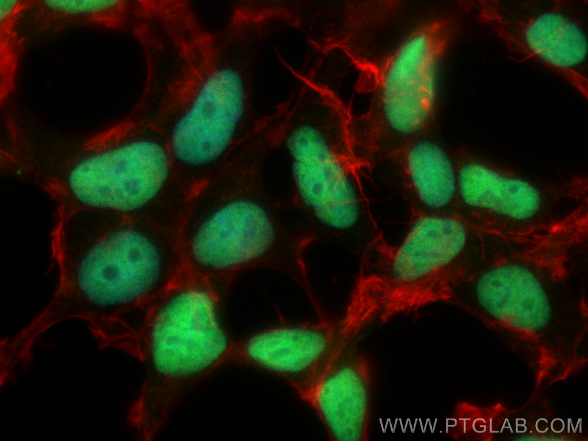 IF Staining of HEK-293 using 21083-1-AP IF Staining of HEK-293 using 21083-1-AP