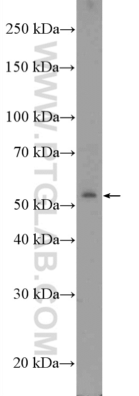 WB analysis of COLO 320 using 20599-1-AP