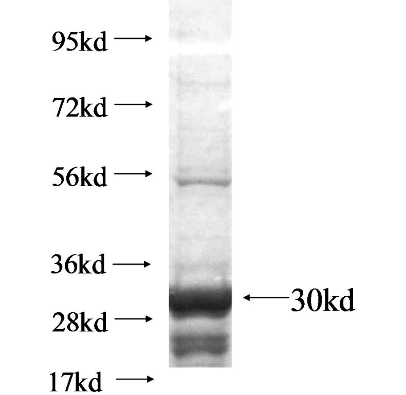 ZNF486 fusion protein Ag15065 SDS-PAGE ZNF486 fusion protein Ag15065 SDS-PAGE