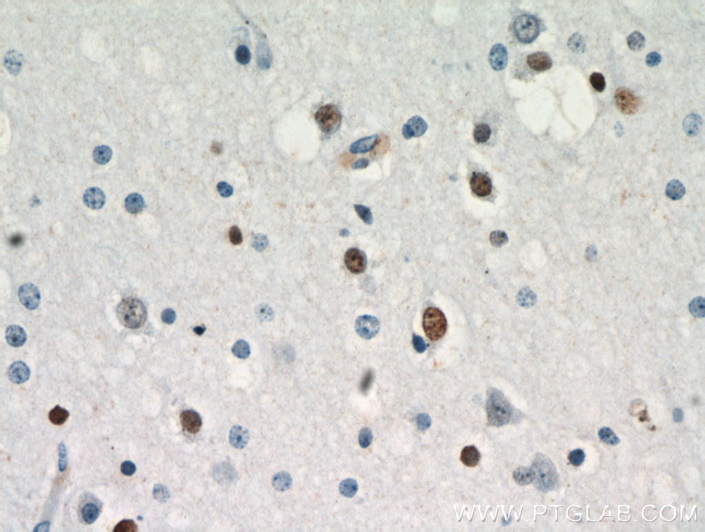 IHC staining of human brain using 21014-1-AP