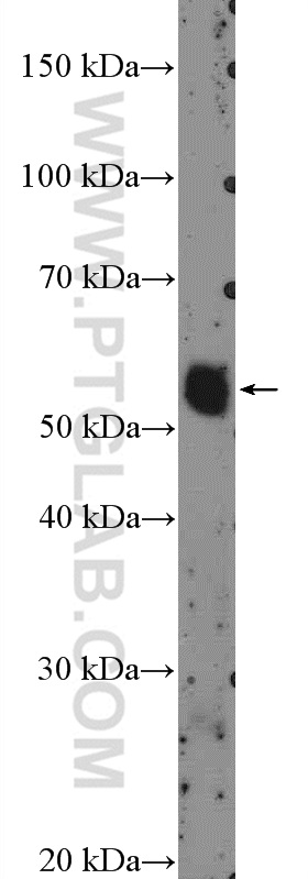 WB analysis of mouse thymus using 21014-1-AP