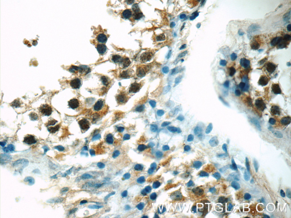 IHC staining of human testis using 25178-1-AP