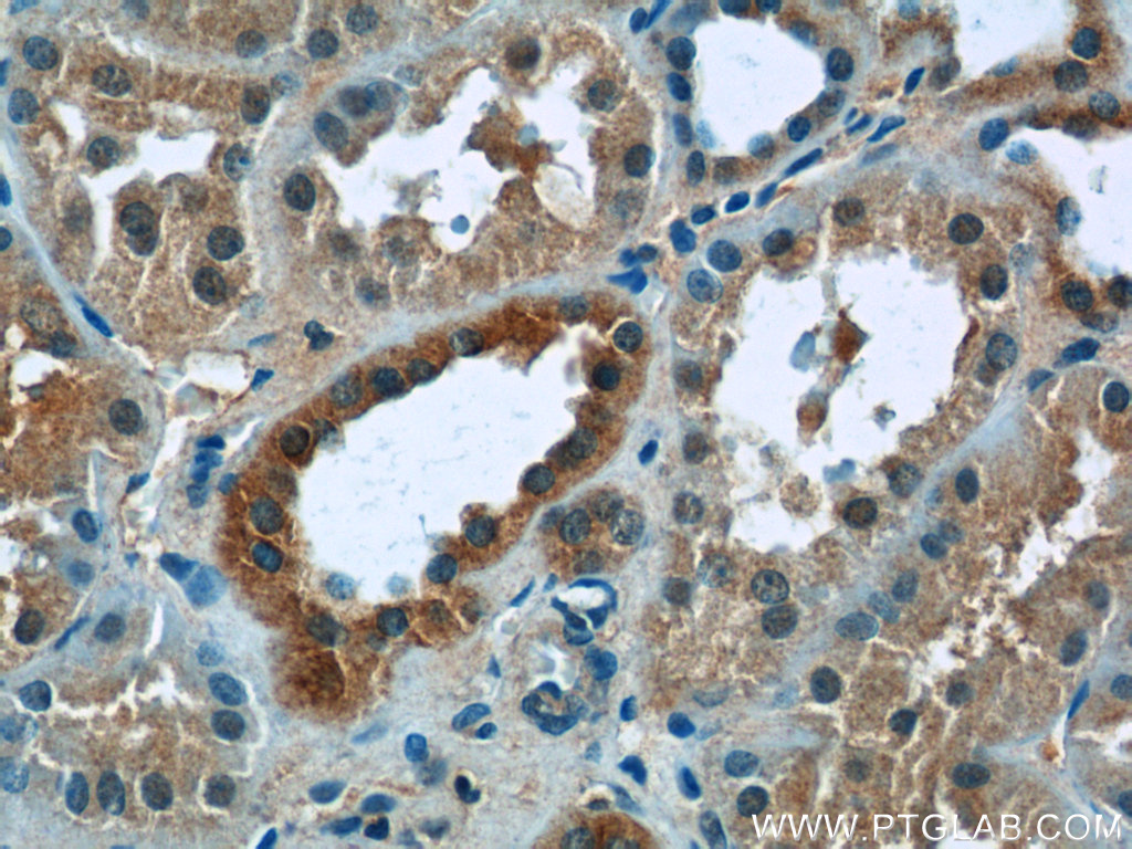 IHC staining of human kidney using 25178-1-AP