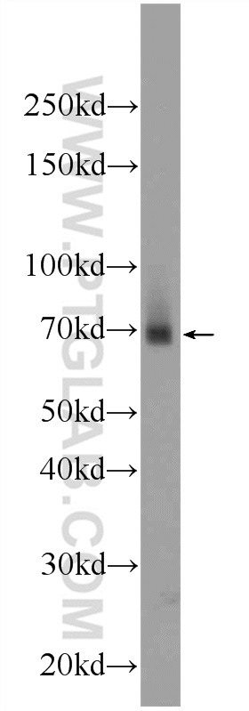 WB analysis of mouse small intestine using 24508-1-AP