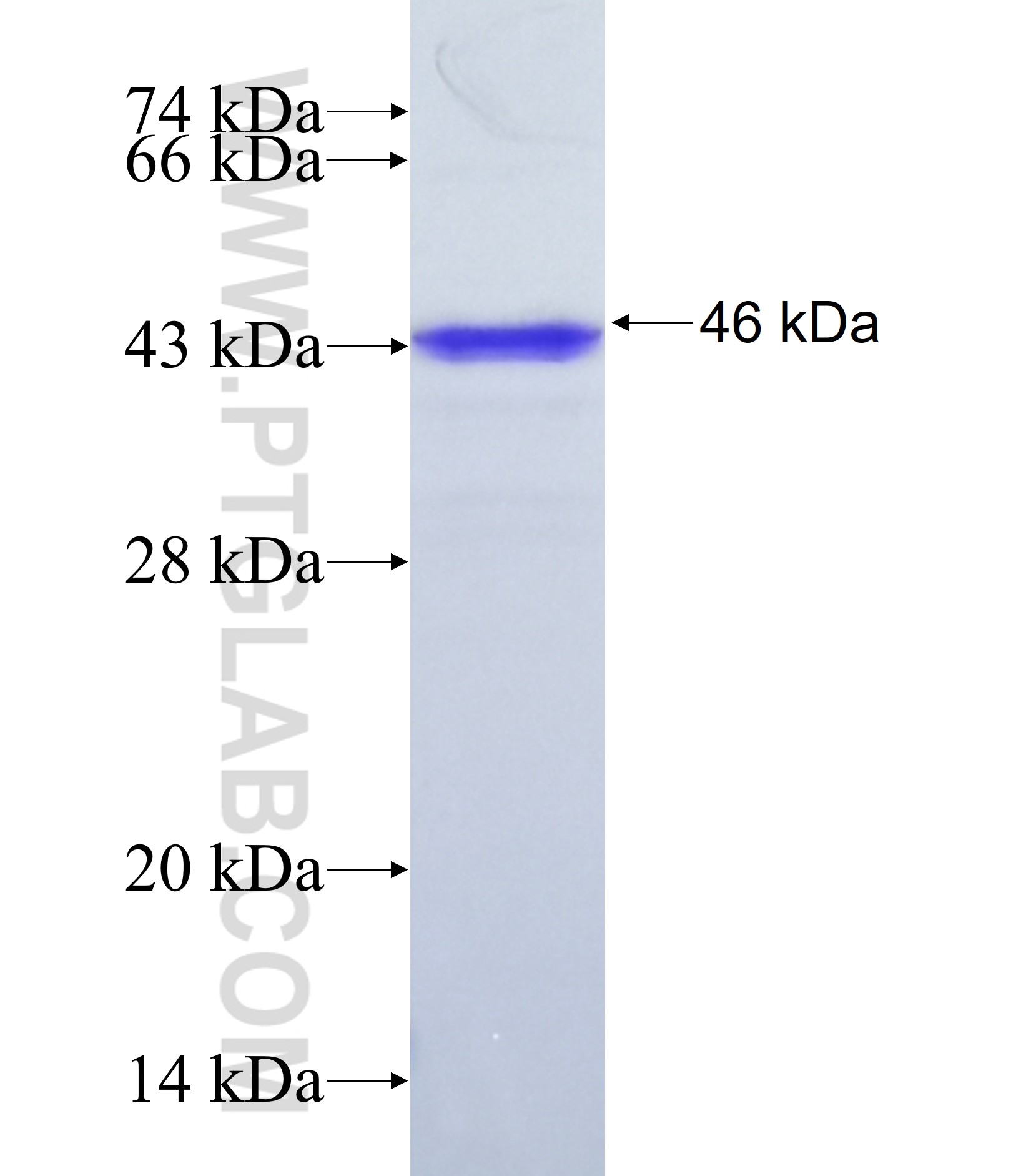 ZNF512B fusion protein Ag38108 SDS-PAGE ZNF512B fusion protein Ag38108 SDS-PAGE