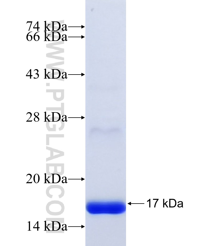 ZNF513 fusion protein Ag40605 SDS-PAGE ZNF513 fusion protein Ag40605 SDS-PAGE