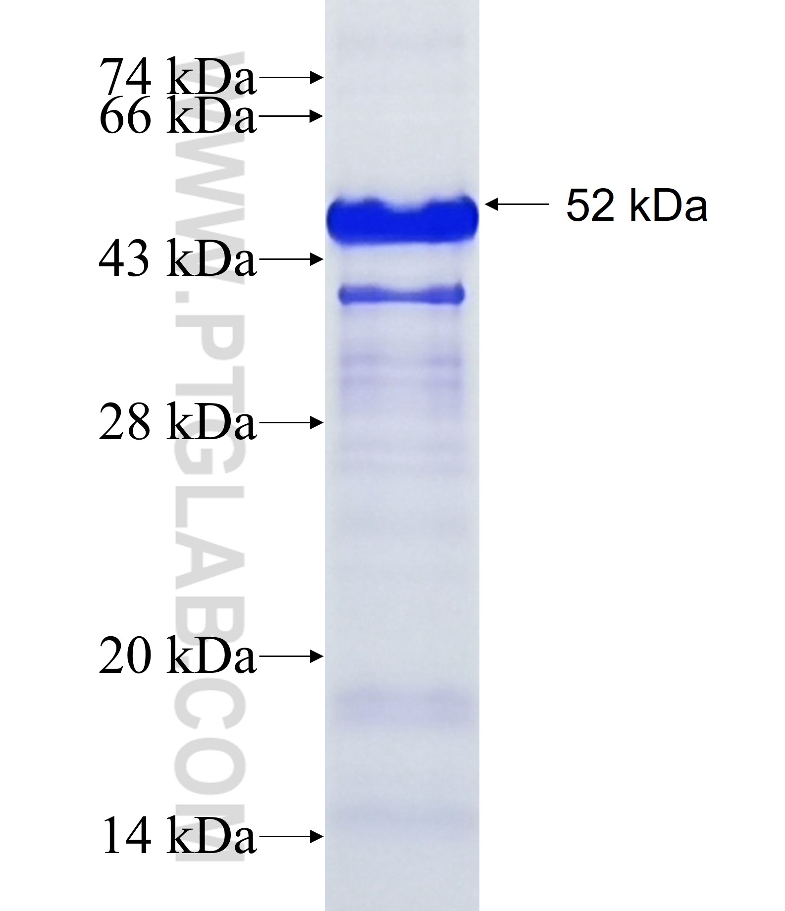 ZNF521 fusion protein Ag20540 SDS-PAGE