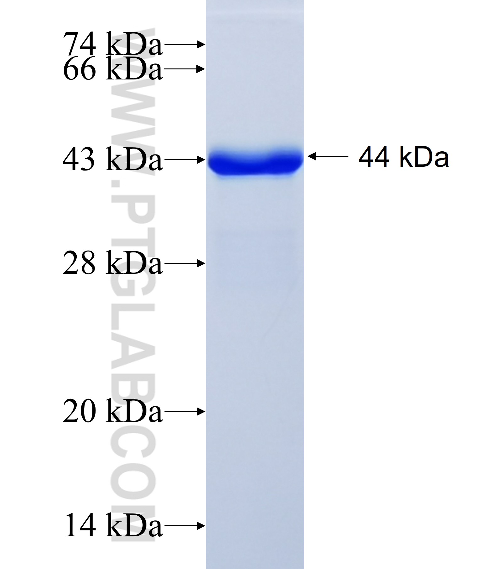 ZNF521 fusion protein Ag41915 SDS-PAGE ZNF521 fusion protein Ag41915 SDS-PAGE