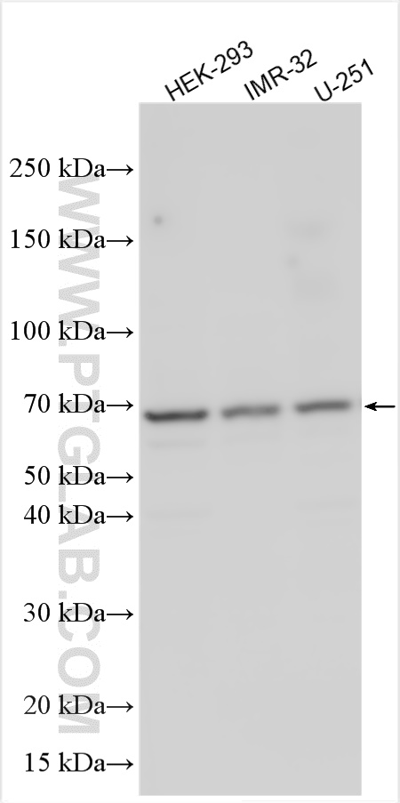 WB analysis using 32288-1-AP (same clone as 32288-1-PBS) WB analysis using 32288-1-AP (same clone as 32288-1-PBS)