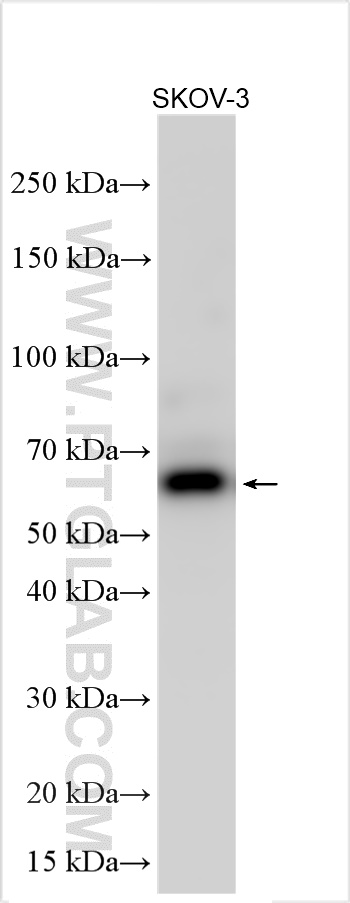 WB analysis using 21365-1-AP