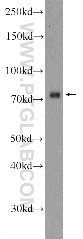 WB analysis of SH-SY5Y using 25592-1-AP