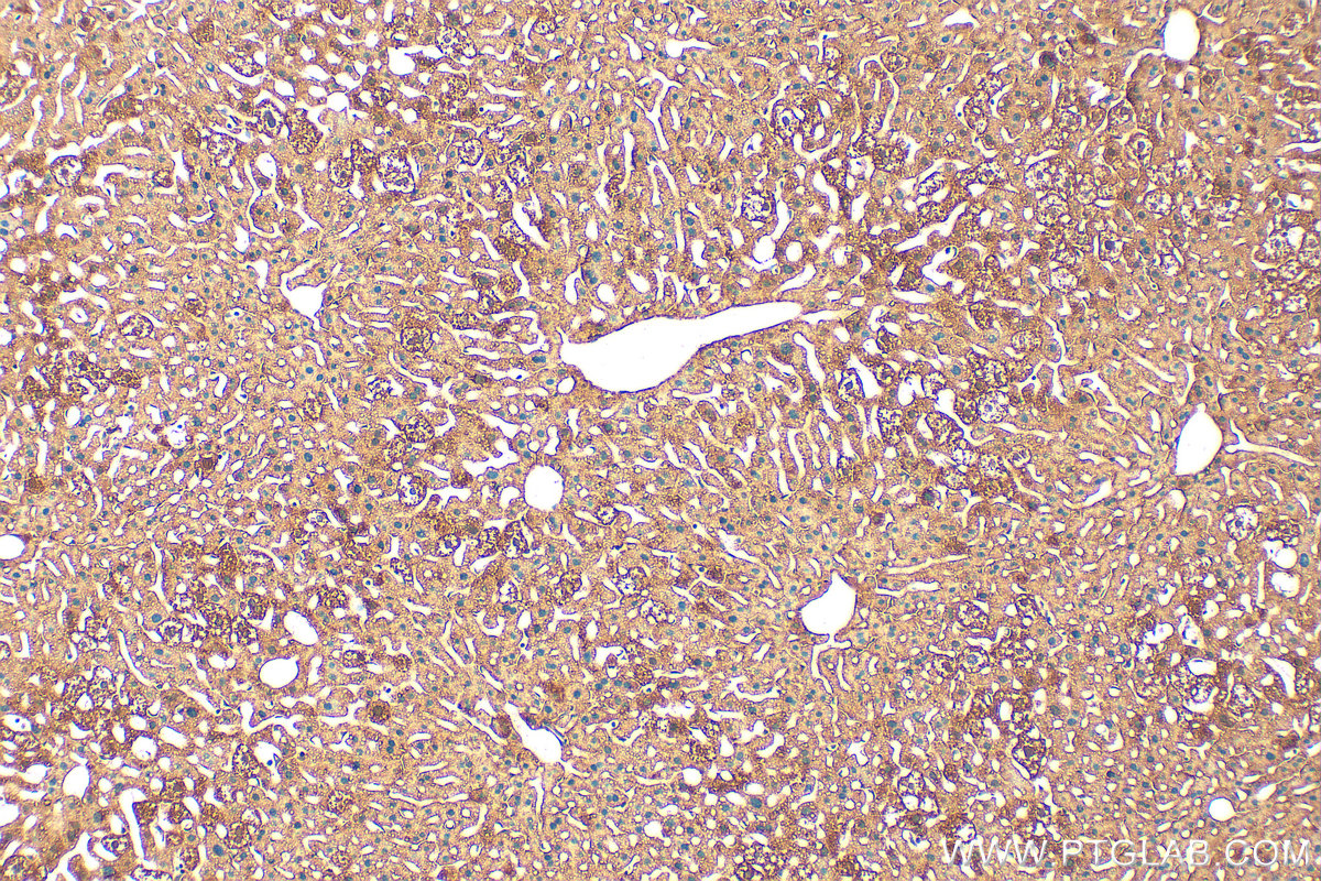 Immunohistochemical analysis of paraffin-embedded mouse liver tissue slide using 33216-1-AP (ZNF551 antibody) at dilution of 1:200 (under 10x lens). Heat mediated antigen retrieval with Tris-EDTA buffer (pH 9.0). IHC staining of mouse liver using 33216-1-AP