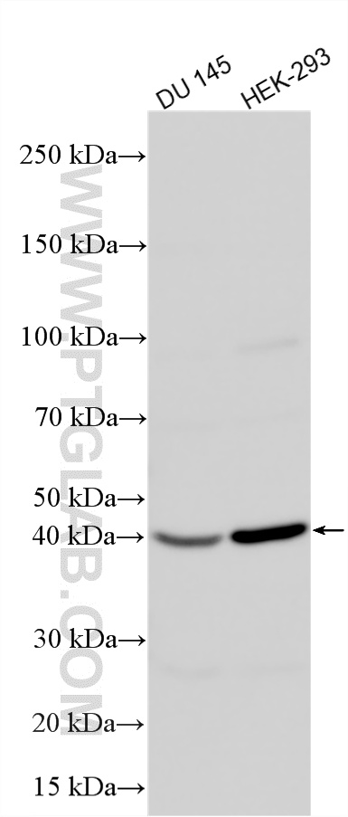 Various lysates were subjected to SDS PAGE followed by western blot with 33216-1-AP (ZNF551 antibody) at dilution of 1:6000 incubated at room temperature for 1.5 hours. WB analysis using 33216-1-AP