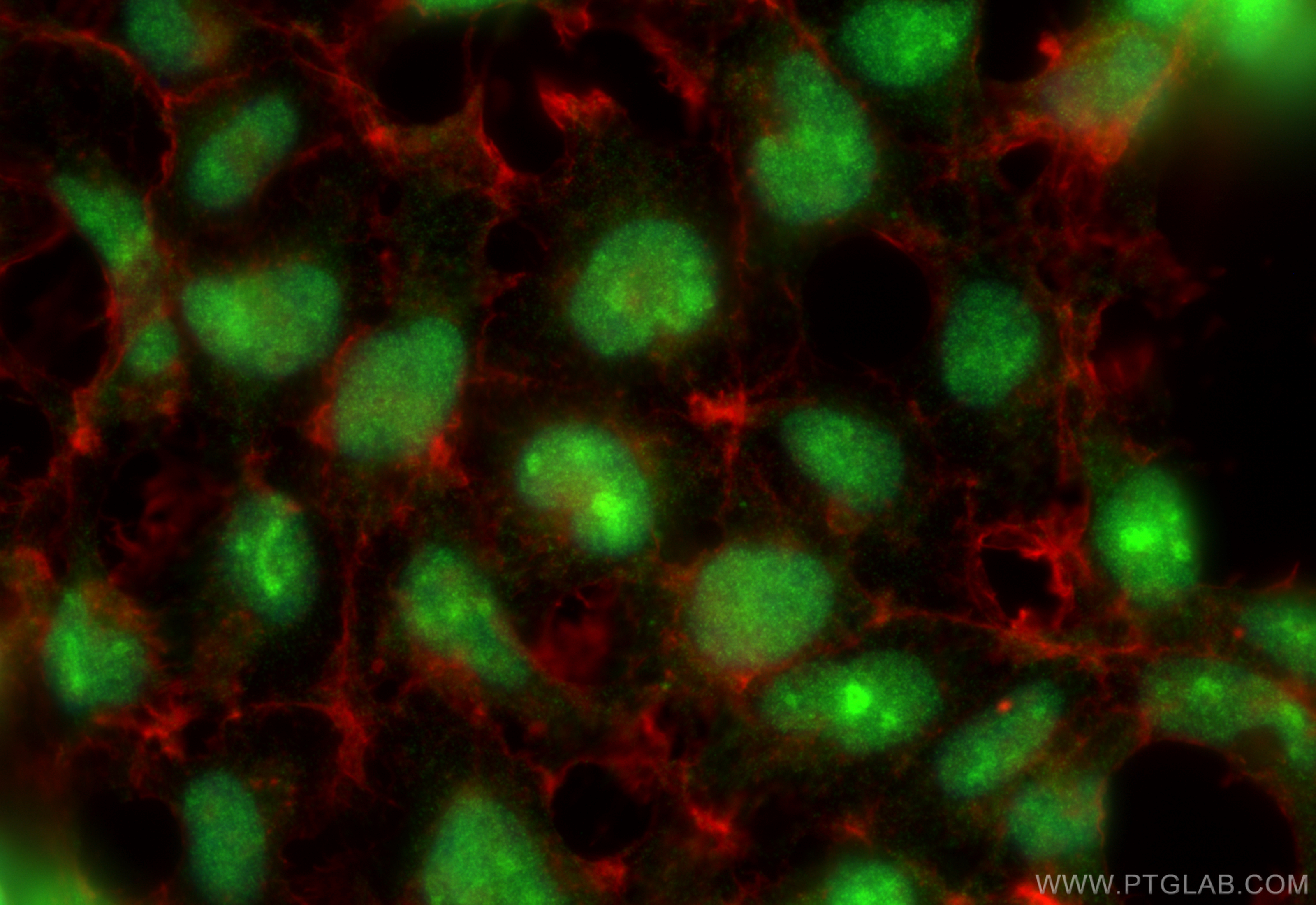 IF Staining of HEK-293 using 21980-1-AP