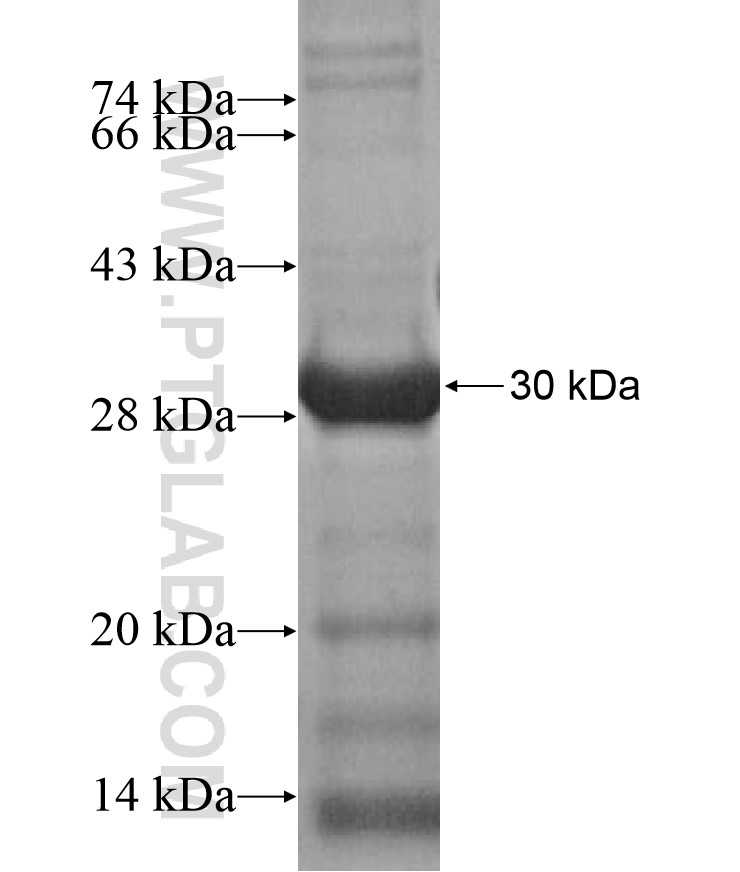 ZNF560 fusion protein Ag17238 SDS-PAGE ZNF560 fusion protein Ag17238 SDS-PAGE