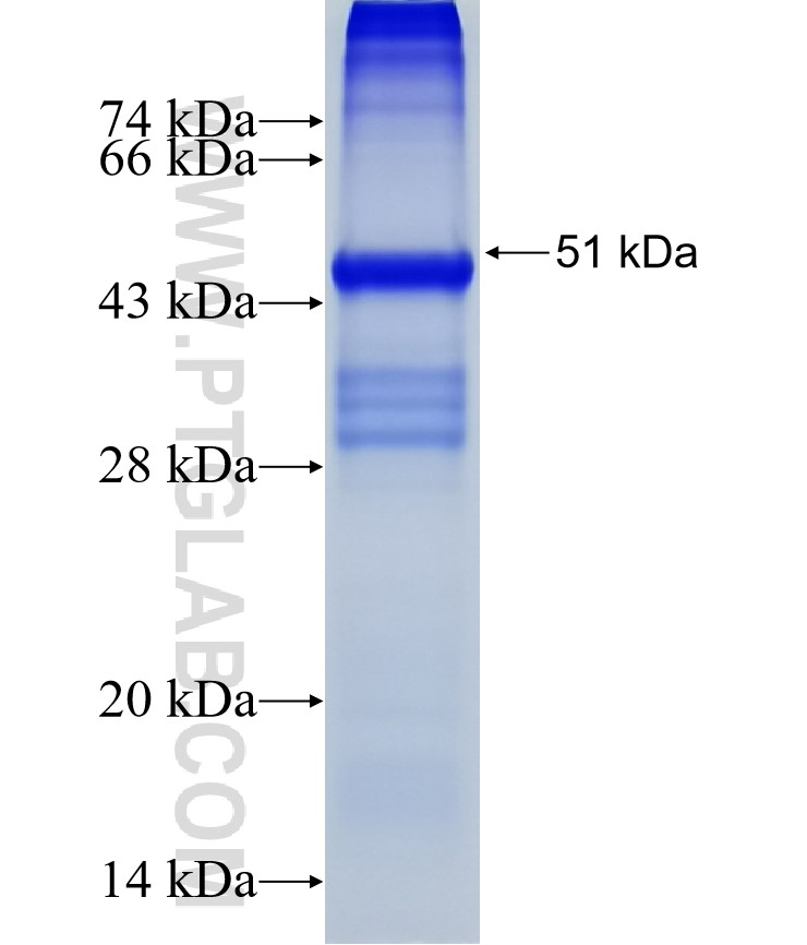 ZNF562 fusion protein Ag37785 SDS-PAGE