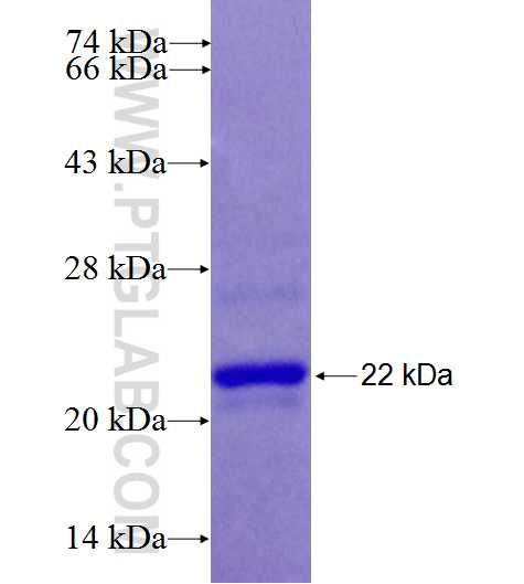 ZNF570 fusion protein Ag26893 SDS-PAGE ZNF570 fusion protein Ag26893 SDS-PAGE