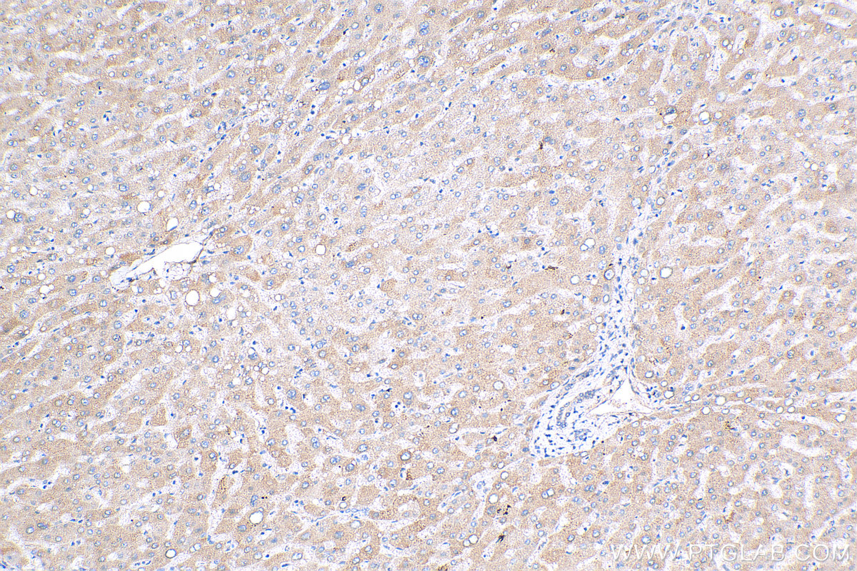 IHC staining of human liver using 24755-1-AP