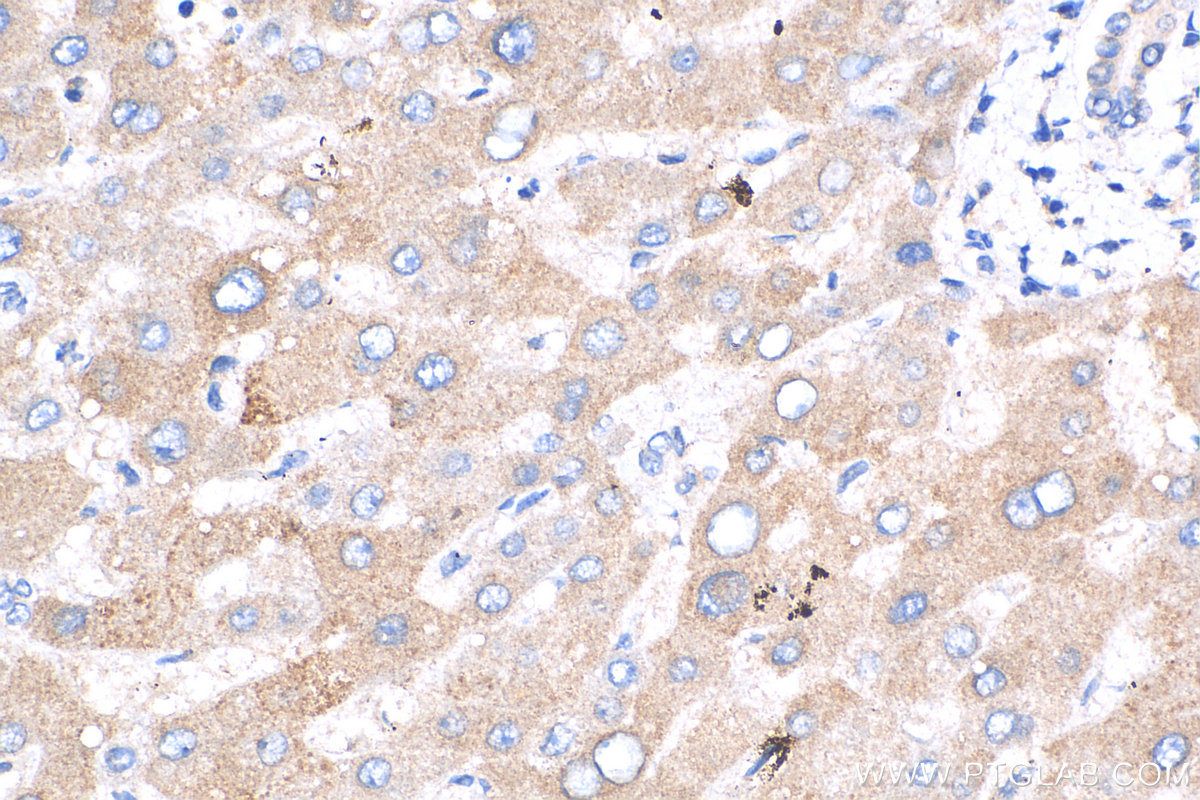 IHC staining of human liver using 24755-1-AP