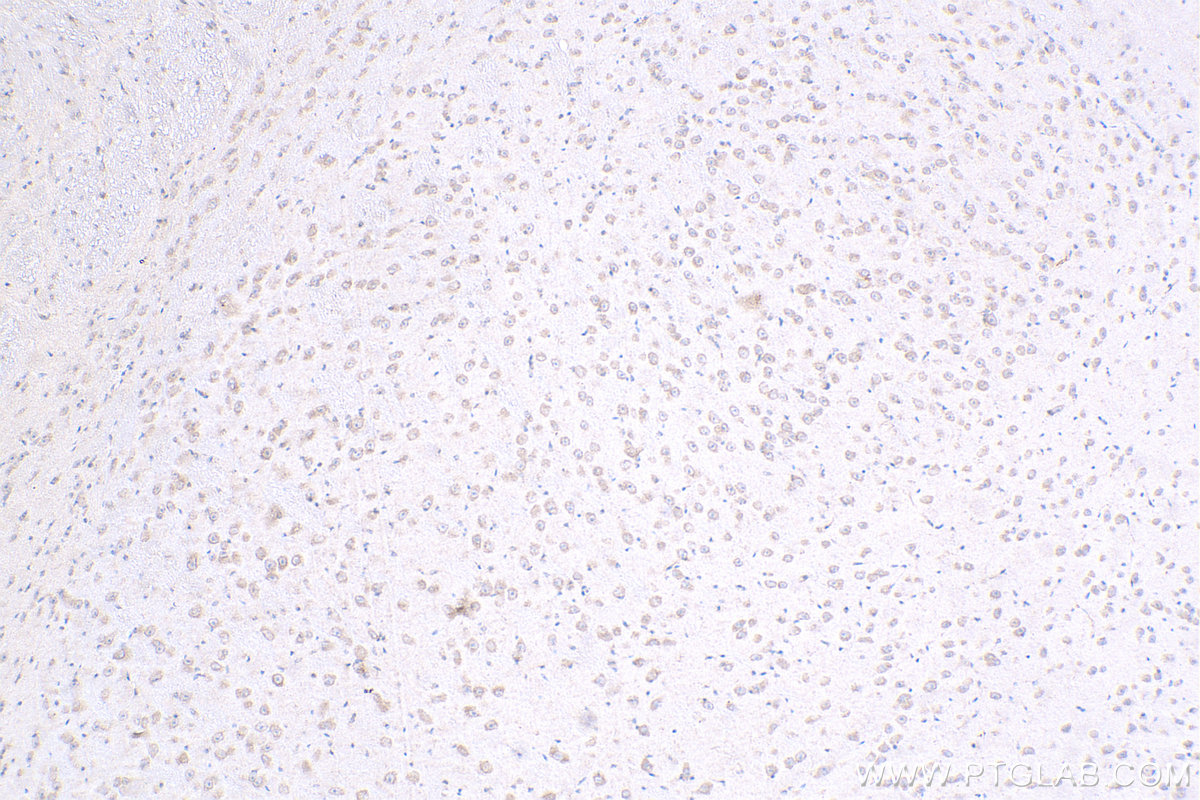ZNF573