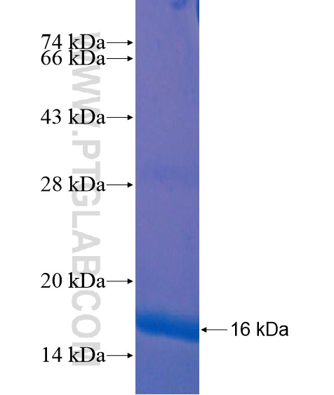 ZNF573 fusion protein Ag20460 SDS-PAGE ZNF573 fusion protein Ag20460 SDS-PAGE