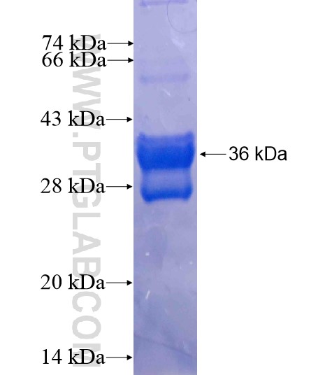 ZNF582 fusion protein Ag15829 SDS-PAGE ZNF582 fusion protein Ag15829 SDS-PAGE