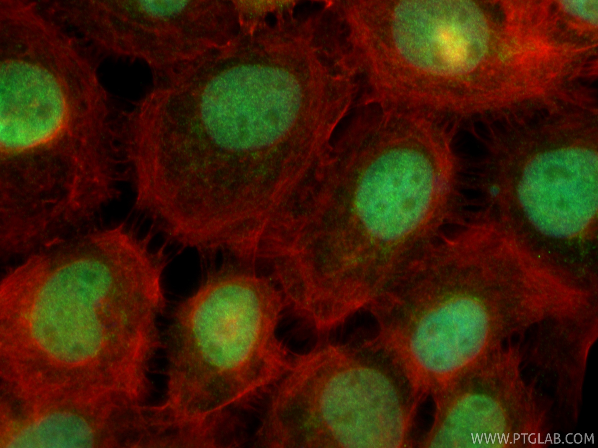 IF Staining of A431 using 33033-1-AP IF Staining of A431 using 33033-1-AP
