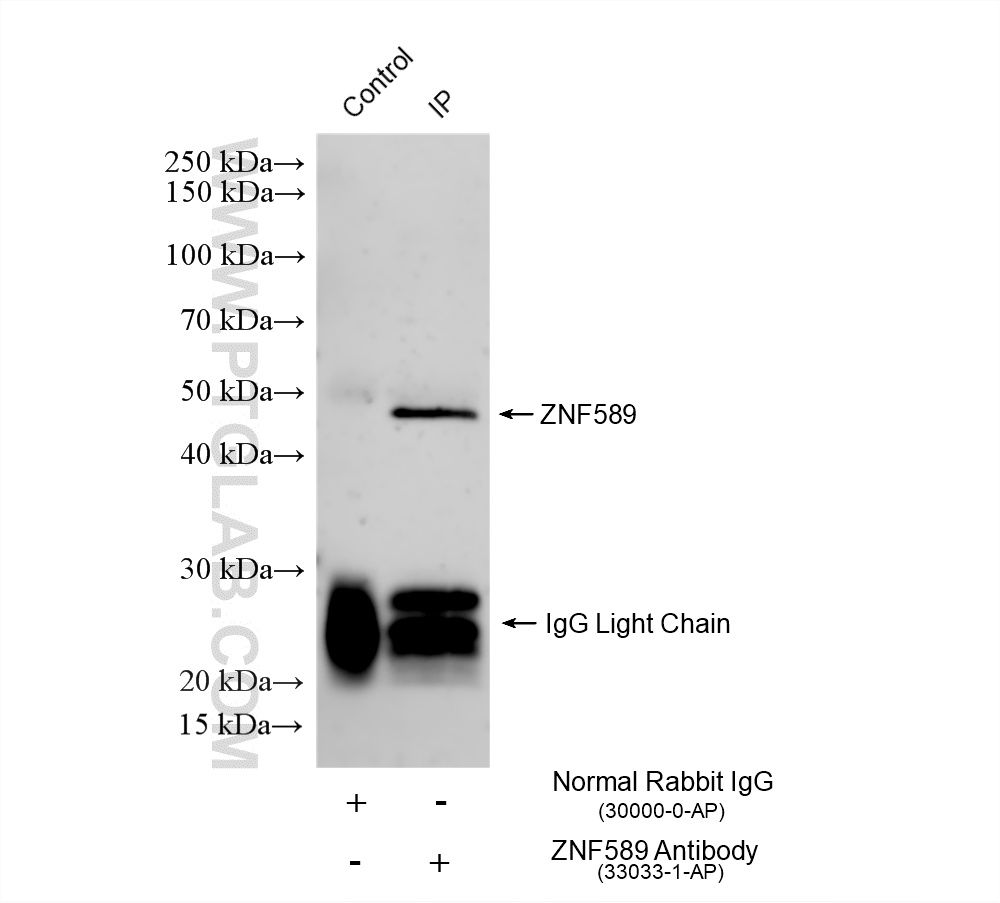 IP experiment of mouse liver using 33033-1-AP