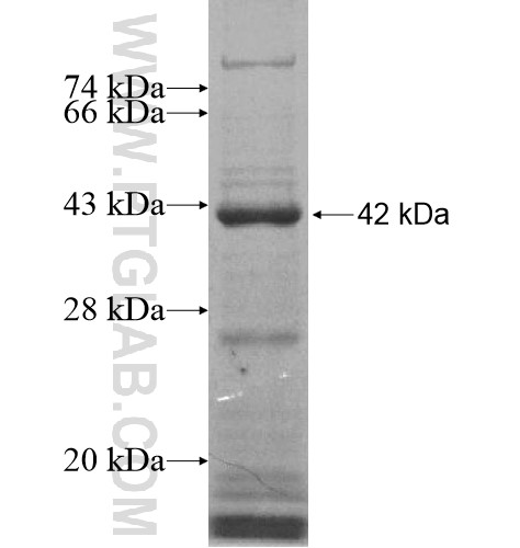 ZNF597 fusion protein Ag15642 SDS-PAGE ZNF597 fusion protein Ag15642 SDS-PAGE