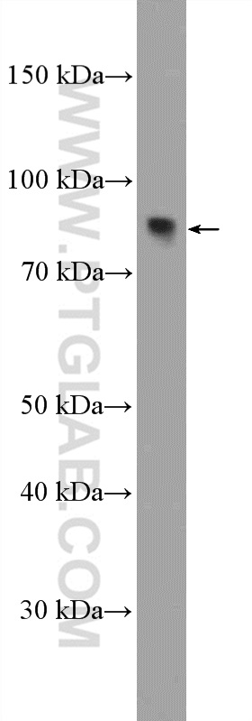 WB analysis of mouse kidney using 20100-1-AP