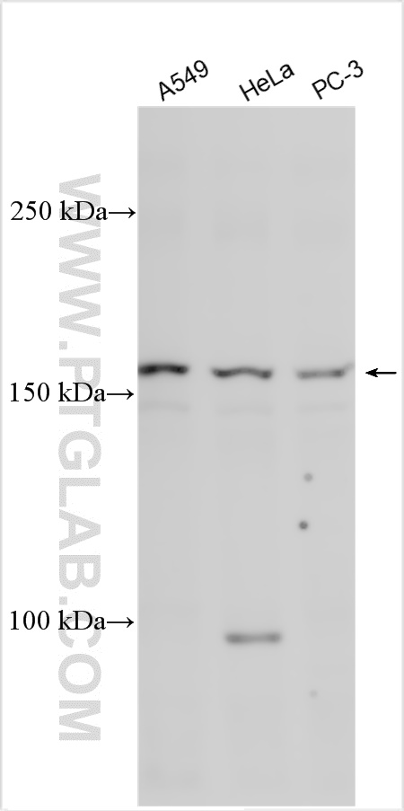 WB analysis using 20063-1-AP