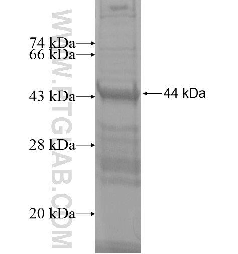 ZNF614 fusion protein Ag14348 SDS-PAGE ZNF614 fusion protein Ag14348 SDS-PAGE