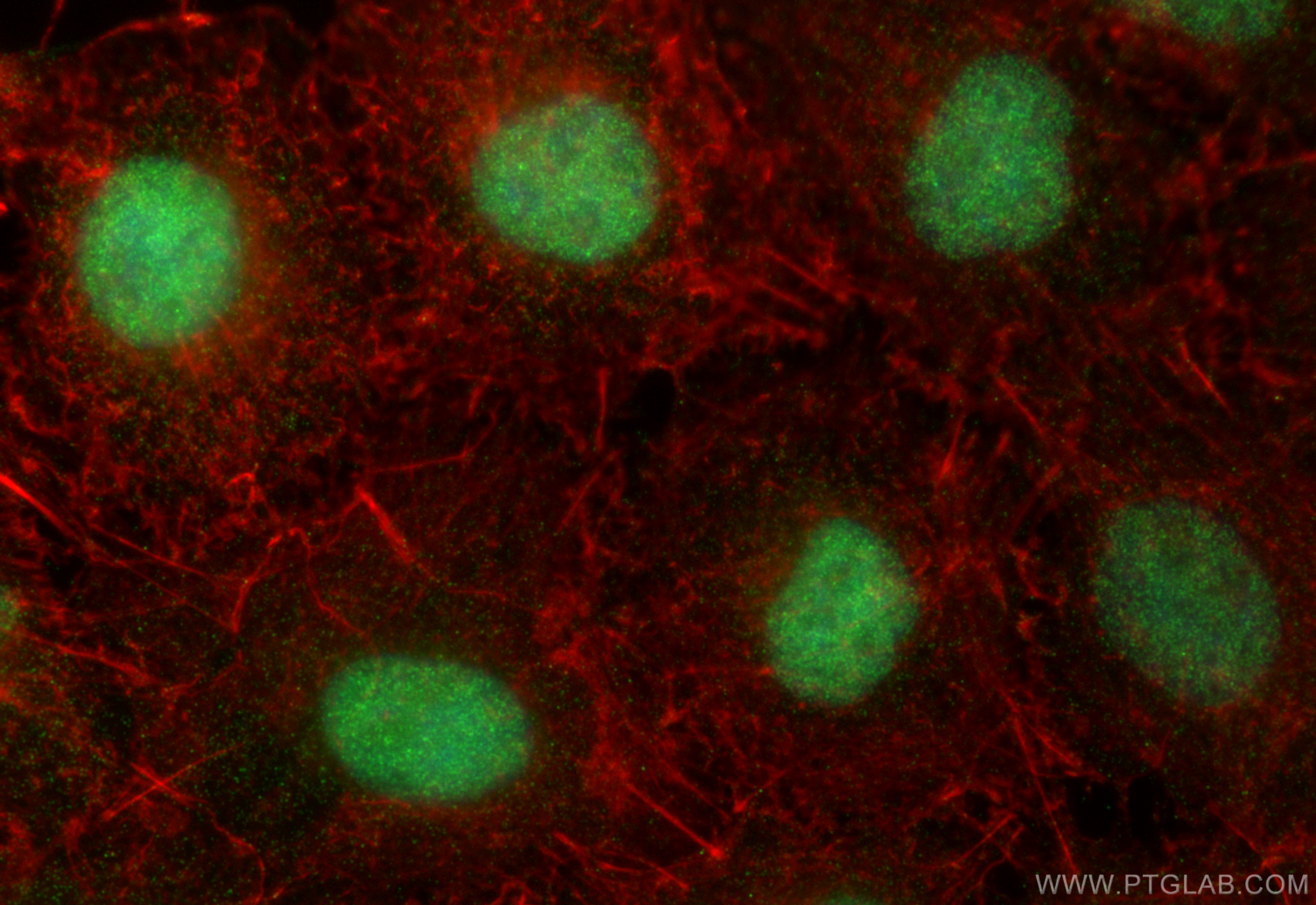 IF Staining of A549 using 31972-1-AP