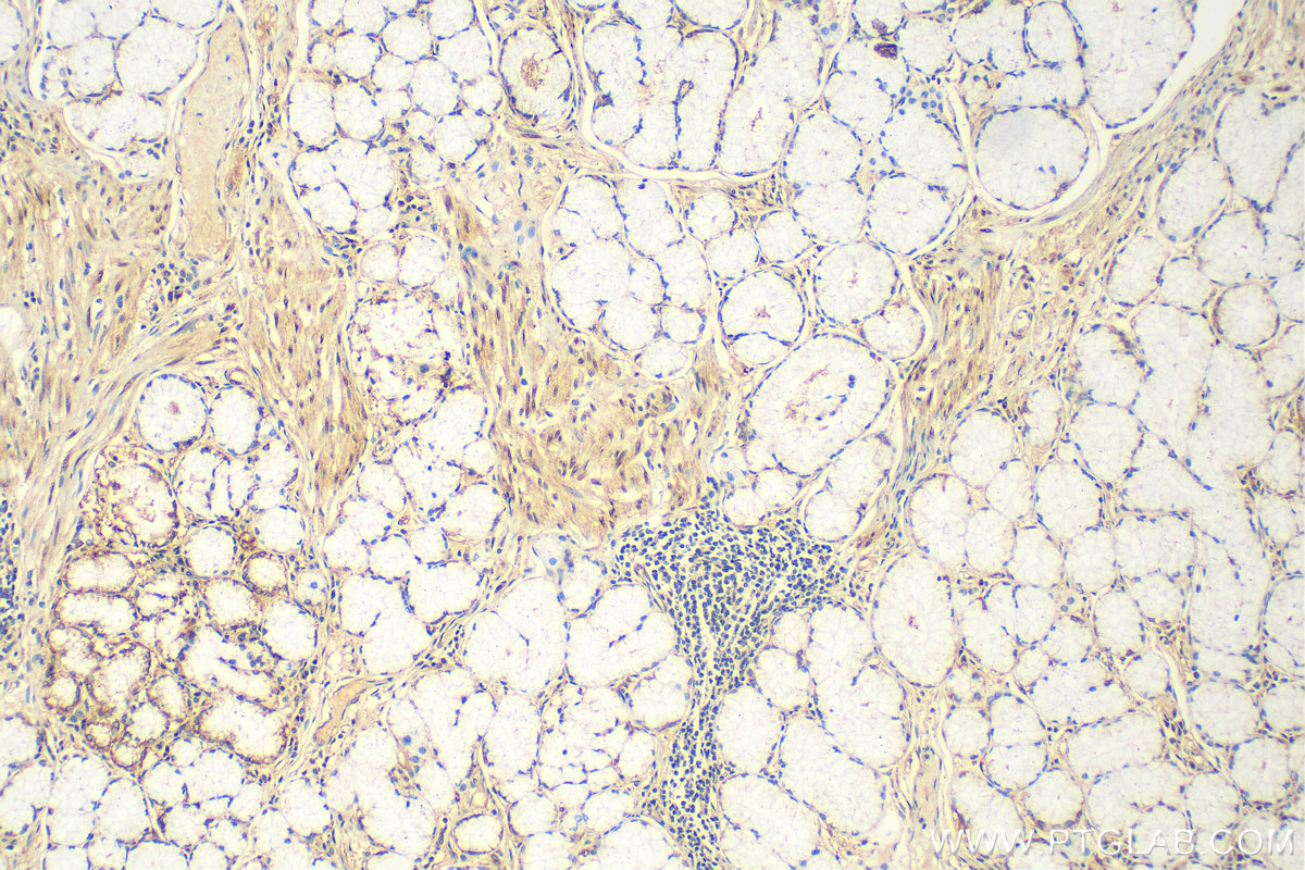 ZNF618