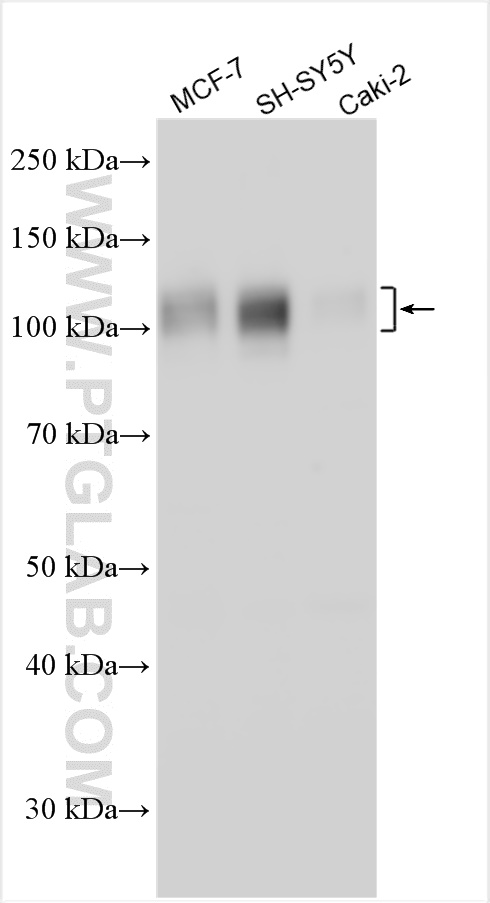 WB analysis using 31972-1-AP