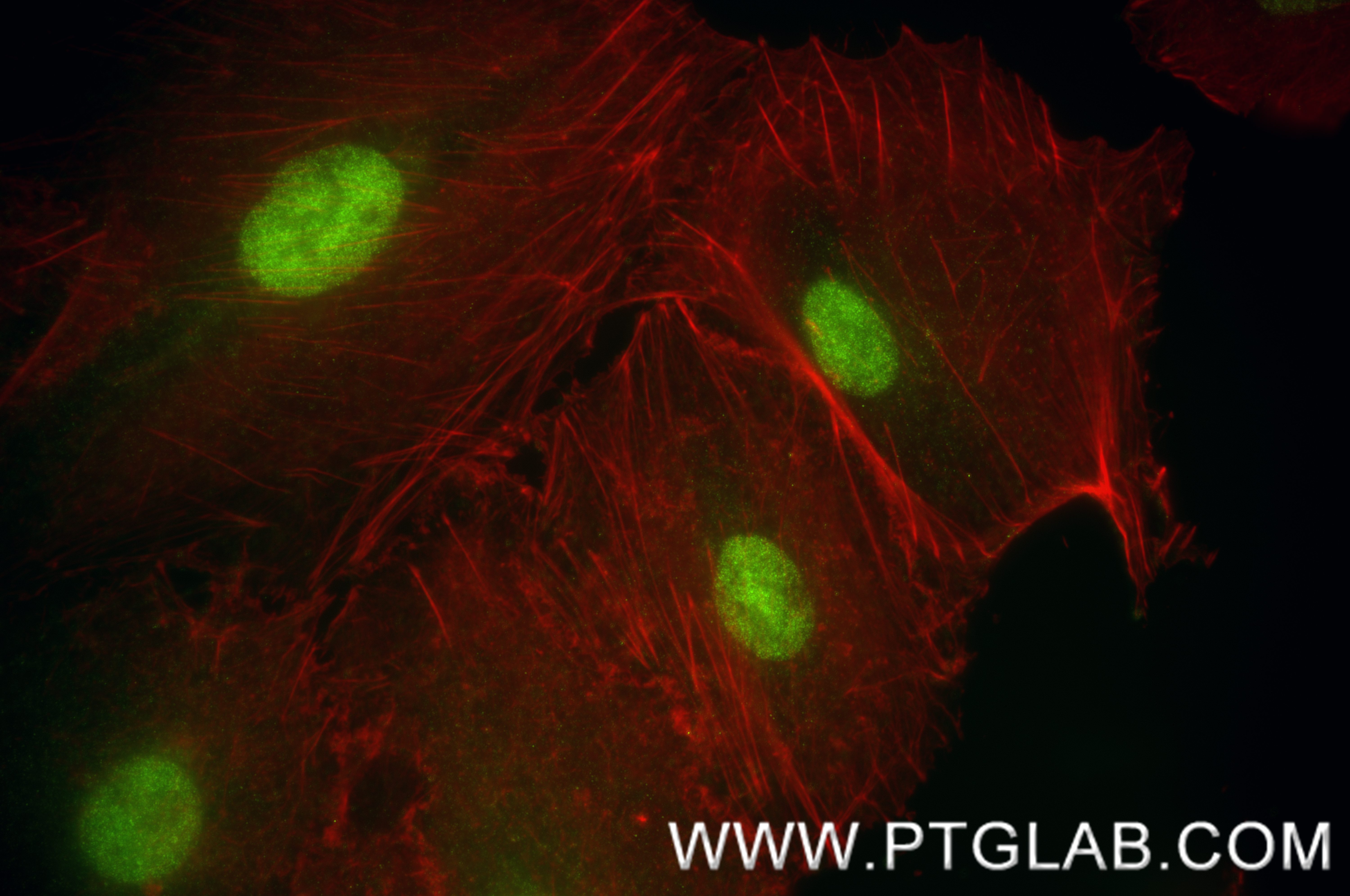 IF Staining of A549 using 84998-1-RR (same clone as 84998-1-PBS)