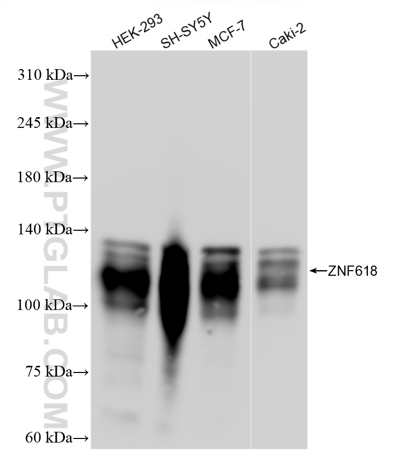 WB analysis using 84998-1-RR