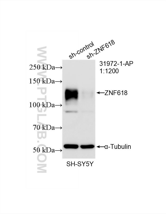 WB result of ZNF618 antibody (84998-1-RR; 1:1200; incubated at room temperature for 1.5 hours) with sh-Control and sh-ZNF618 transfected SH-SY5Y cells. WB analysis of SH-SY5Y using 84998-1-RR