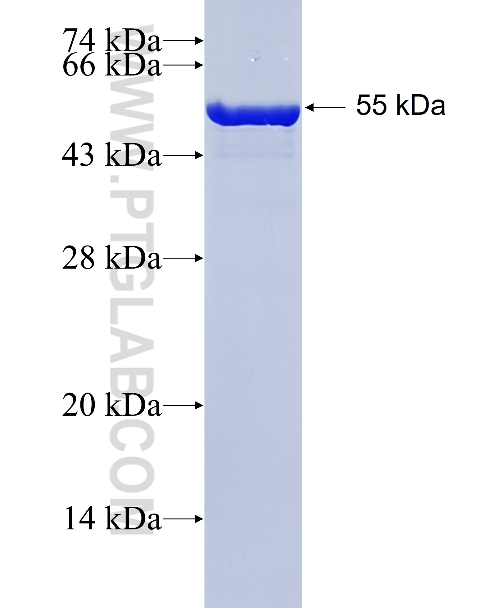 ZNF618 fusion protein Ag36487 SDS-PAGE