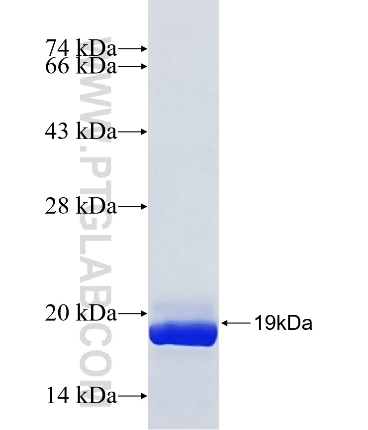 ZNF621 fusion protein Ag38000 SDS-PAGE ZNF621 fusion protein Ag38000 SDS-PAGE