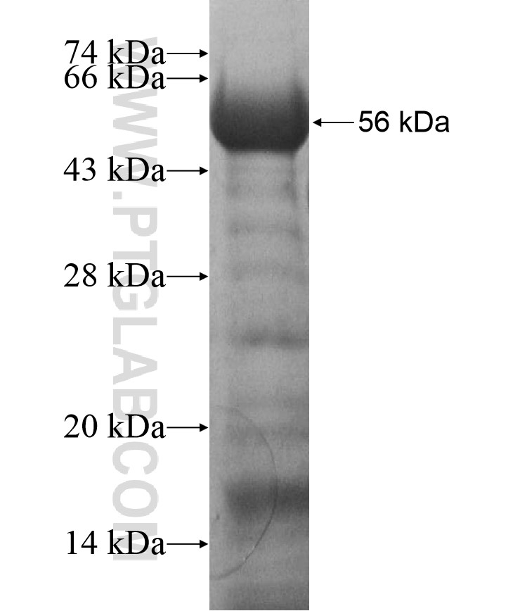 ZNF622 fusion protein Ag16973 SDS-PAGE ZNF622 fusion protein Ag16973 SDS-PAGE