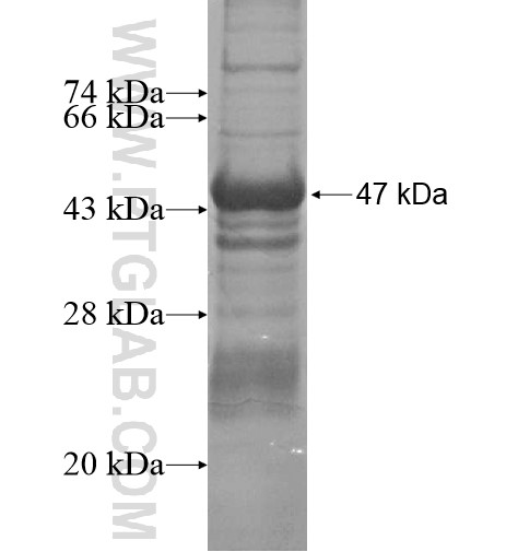 ZNF624 fusion protein Ag15700 SDS-PAGE ZNF624 fusion protein Ag15700 SDS-PAGE