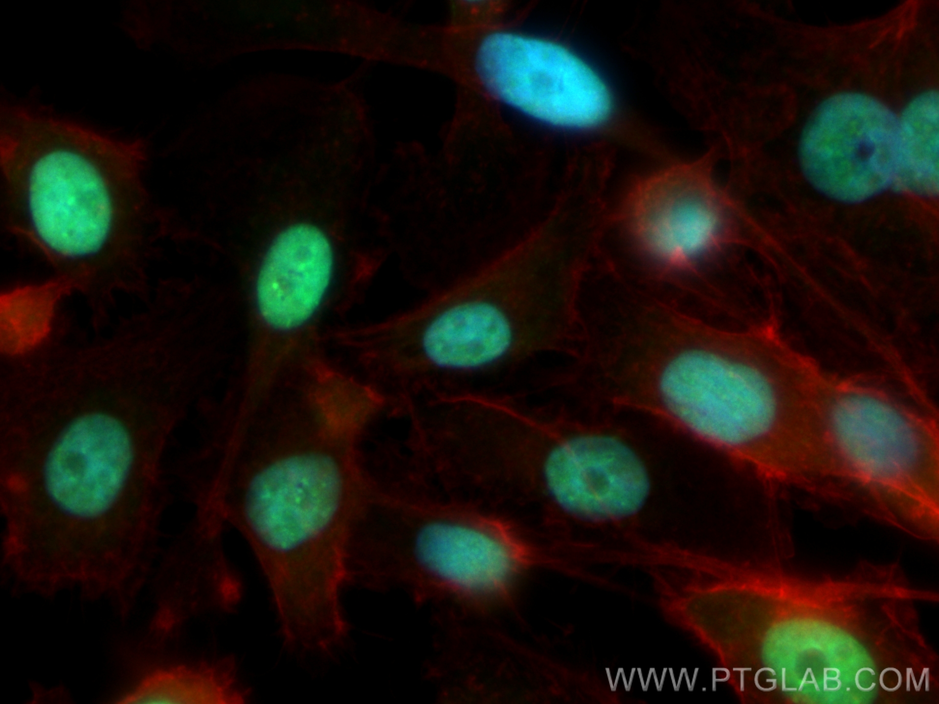 IF Staining of PC-3 using 21458-1-AP